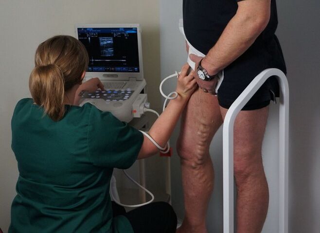 exame de veas antes da coagulación con láser para varices