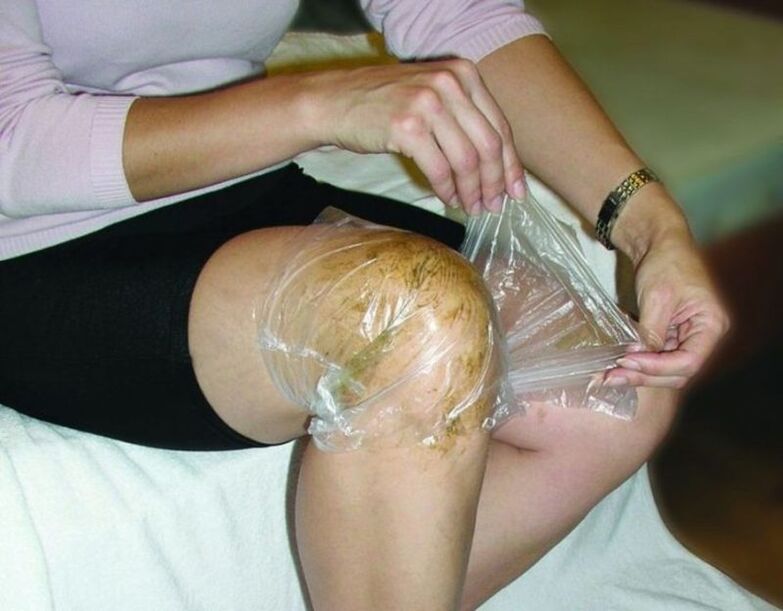compresa para varices