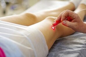 tratamento con láser para varices